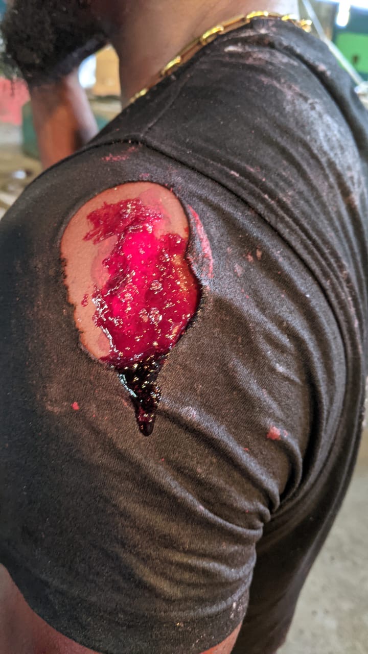 Battle Wounds & Trauma SFX